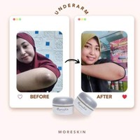 Moreskin Underarm Cream (Unarm Nasa)